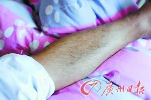 少女患两性畸形有男性生殖器 被取笑为“人妖”