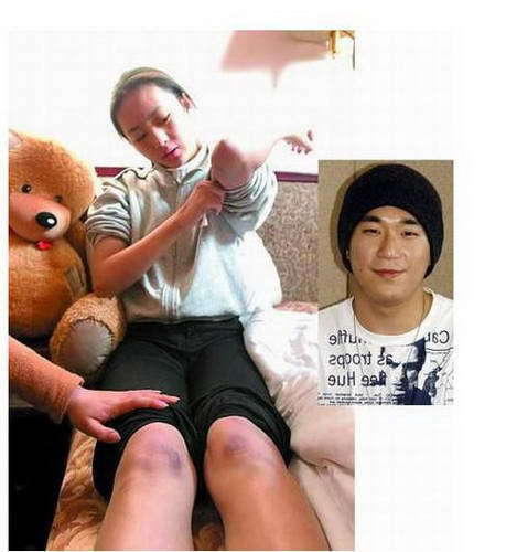 她被称作小章子怡遭前男友暴打 33岁恋上50岁富商 她被称作小章子怡遭前男友暴打 33岁恋上50岁富商