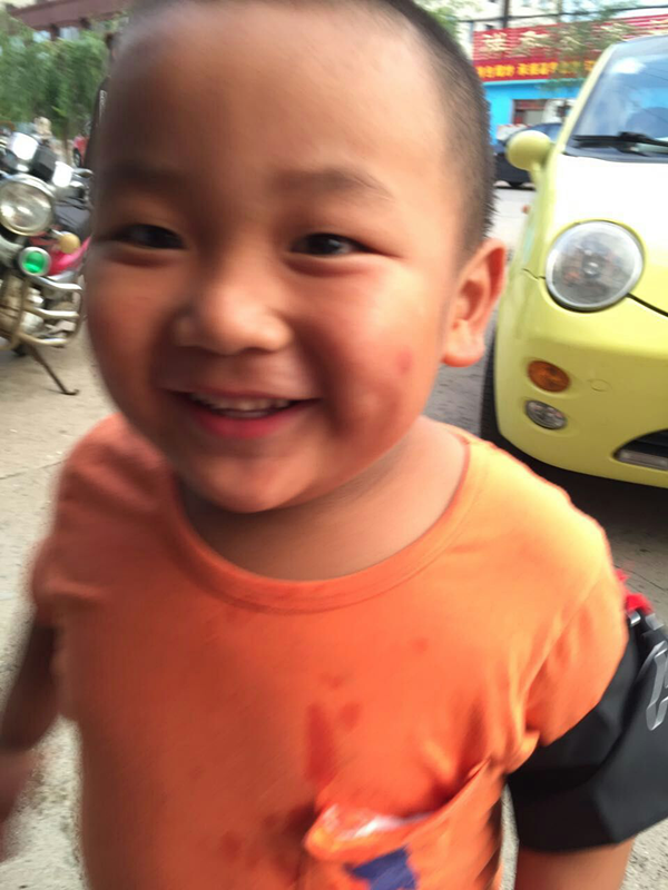 小涛被砍之前的照片