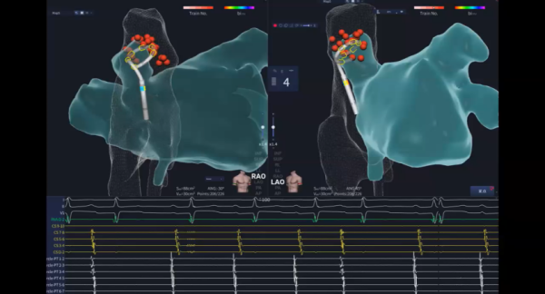 4f914733cbce2927155a22b8a5dea49e.png 4f914733cbce2927155a22b8a5dea49e.png