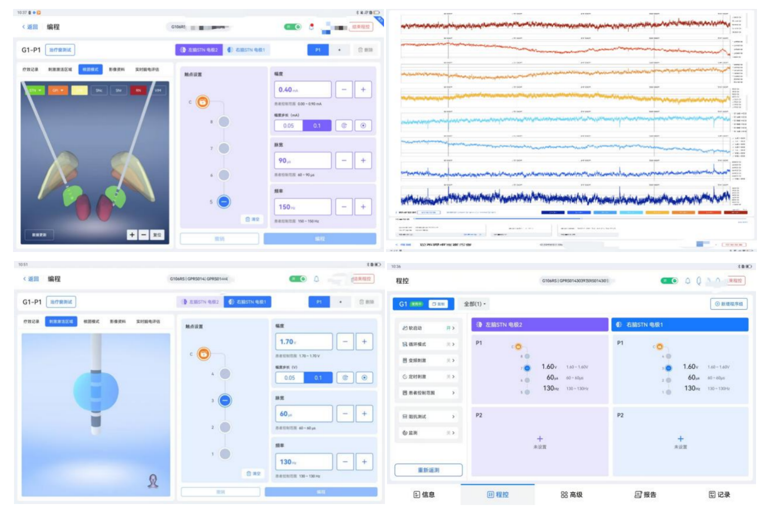 789499ebb45d47aae54d66759a348250.png 789499ebb45d47aae54d66759a348250.png