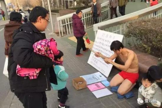 孩子患先天性眼疾