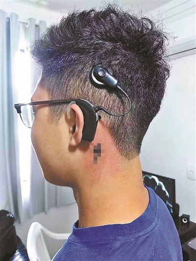 小伙乘地铁丢20万元人造耳蜗 家属盼好心人归还