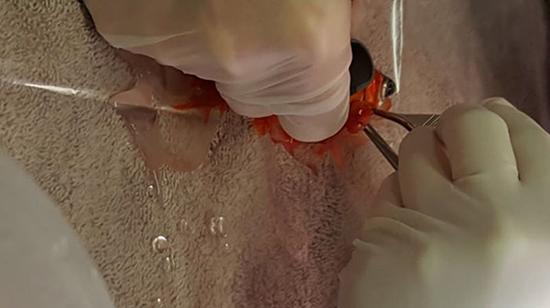 一条20岁的金鱼,最近经历了一场去除肿瘤的手术