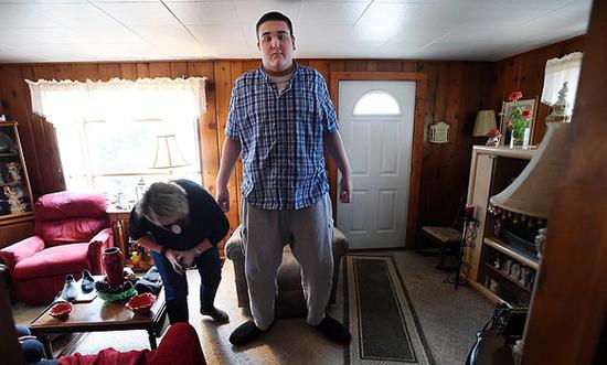 19岁青年穿上3D打印鞋子 常因脚太大买不到鞋子